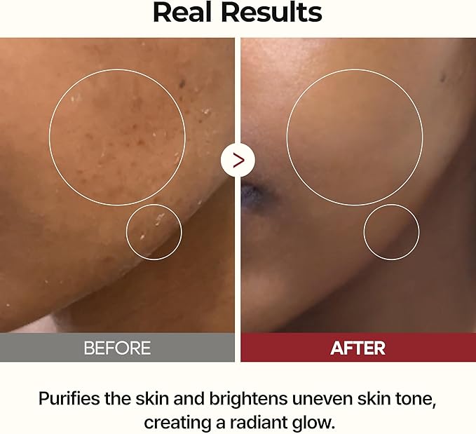 DM Rice Peel Ampoule
